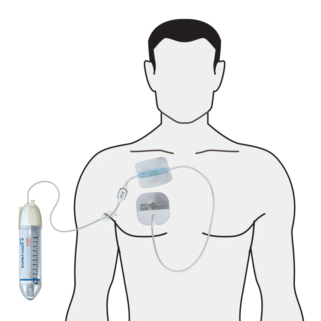 Imfuser Infusion Therapy – Nipro Australia